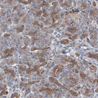 Immunohistochemistry-Paraffin: POLR1D Antibody [NBP1-82655]
