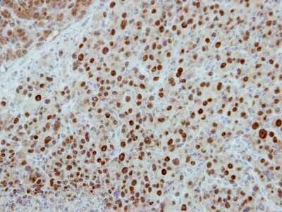 Immunohistochemistry-Paraffin: POLR1D Antibody [NBP2-19884]