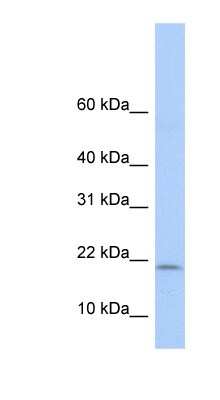 Western Blot: POLR1D Antibody [NBP1-52917]