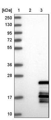 Western Blot: POLR1D Antibody [NBP1-82655]