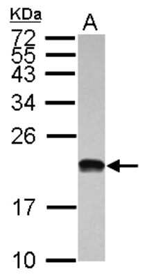 Western Blot: POLR1D Antibody [NBP2-19884]