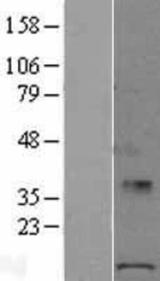 Western Blot: POLR1D Overexpression Lysate [NBL1-14577]