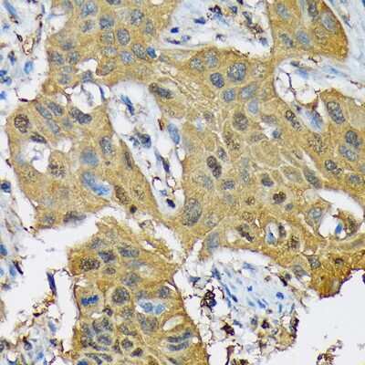 Immunohistochemistry-Paraffin: POLR2C Antibody (3T8K8) [NBP3-16871]