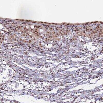 Immunohistochemistry: POLR2C Antibody [NBP1-80817]
