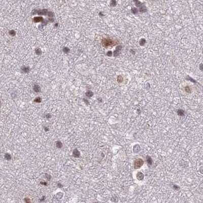 Immunohistochemistry-Paraffin: POLR2C Antibody [NBP1-80817]
