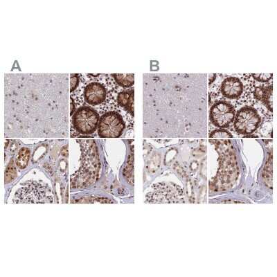 Immunohistochemistry-Paraffin: POLR2C Antibody [NBP1-80818]