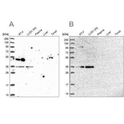 Western Blot: POLR2C Antibody [NBP1-80817]