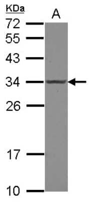 Western Blot: POLR2C Antibody [NBP2-19885]