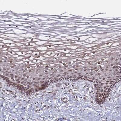 Immunohistochemistry-Paraffin: POLR2D Antibody [NBP1-92280]