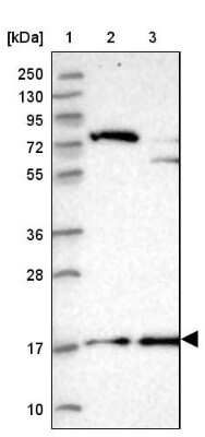 Western Blot: POLR2D Antibody [NBP1-92280]