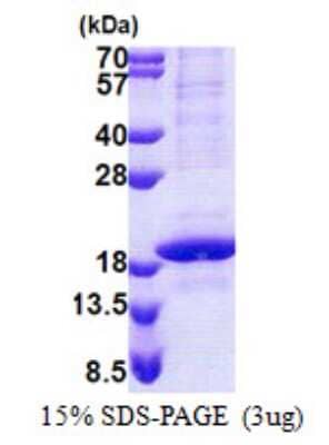 SDS-PAGE: Recombinant Human POLR2D His Protein [NBP2-23343]