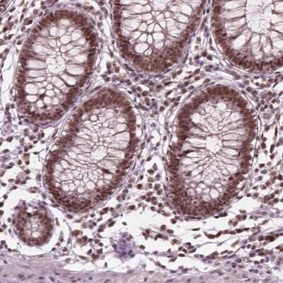 Immunohistochemistry-Paraffin: POLR2E Antibody [NBP2-49577]