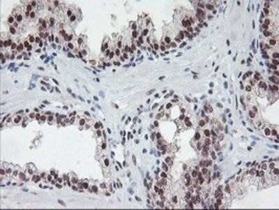 Immunohistochemistry: POLR2E Antibody (OTI3B5) - Azide and BSA Free [NBP2-73518]
