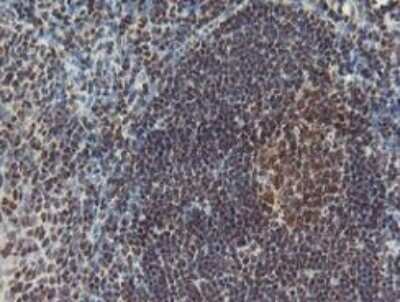 Immunohistochemistry-Paraffin: POLR2E Antibody (OTI3B5) [NBP2-00482]