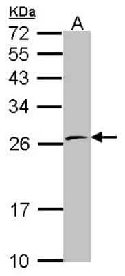 Western Blot: POLR2E Antibody [NBP2-15100]