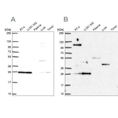 Western Blot: POLR2E Antibody [NBP2-49577]