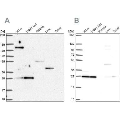 Western Blot: POLR2E Antibody [NBP2-57185]