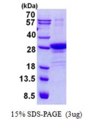 SDS-PAGE: Recombinant Human POLR2E His Protein [NBP2-23344]