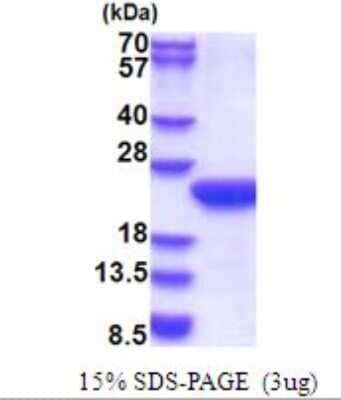 SDS-PAGE: Recombinant Human POLR2F His Protein [NBP2-51660]