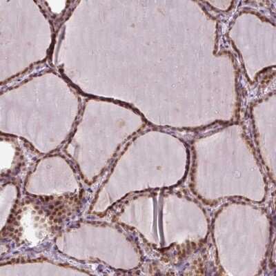 Immunohistochemistry-Paraffin: POLR2G Antibody [NBP2-47329]