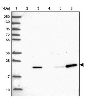 Western Blot: POLR2G Antibody [NBP2-47329]