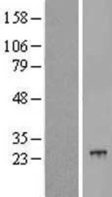 Western Blot: POLR2G Overexpression Lysate [NBL1-14584]