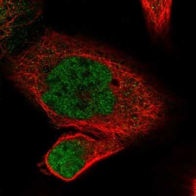 Immunocytochemistry/ Immunofluorescence: POLR2J Antibody [NBP2-46733]