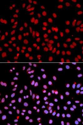 Immunocytochemistry/ Immunofluorescence: POLR2J Antibody - BSA Free [NBP2-93617]