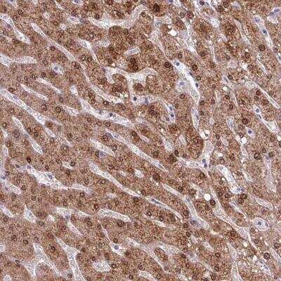 Immunohistochemistry: POLR2J Antibody [NBP2-46733]