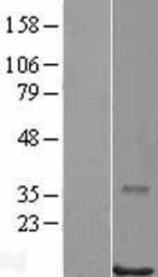 Western Blot: POLR2J Overexpression Lysate [NBL1-14586]