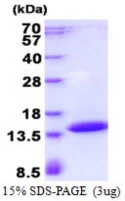 SDS-PAGE: Recombinant Human POLR2J3 His Protein [NBP2-23349]