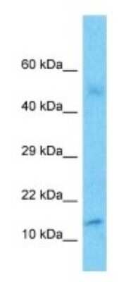 Western Blot: POLR2J3 Antibody [NBP3-09686]