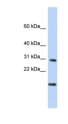 Western Blot: POLR2K Antibody [NBP1-55166]