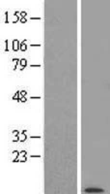 Western Blot: POLR2K Overexpression Lysate [NBL1-14587]