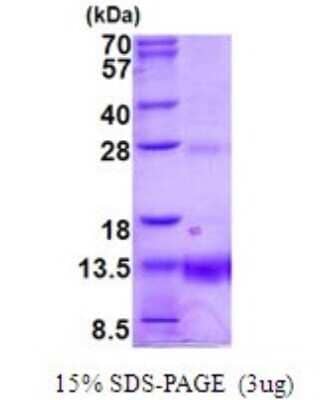 SDS-PAGE: Recombinant Human POLR2K His Protein [NBP2-51901]