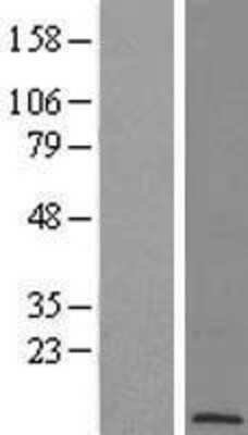 Western Blot: POLR2L Overexpression Lysate [NBL1-14588]