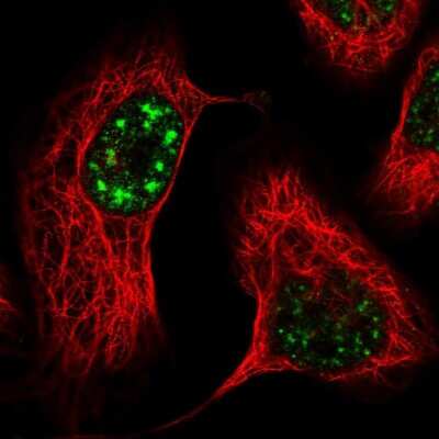 Immunocytochemistry/ Immunofluorescence: POLR3B Antibody [NBP1-84628]