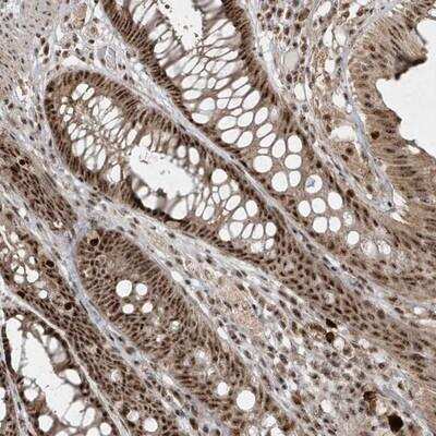 Immunohistochemistry-Paraffin: POLR3B Antibody [NBP1-84628]