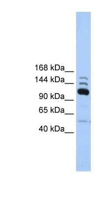 Western Blot: POLR3B Antibody [NBP1-54363]