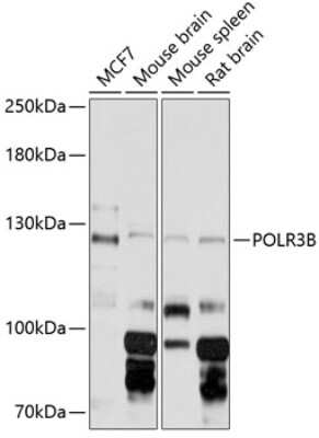 Western Blot: POLR3B AntibodyAzide and BSA Free [NBP2-93137]