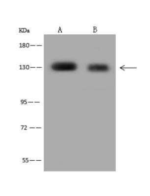 Western Blot: POLR3B Antibody [NBP3-06317]