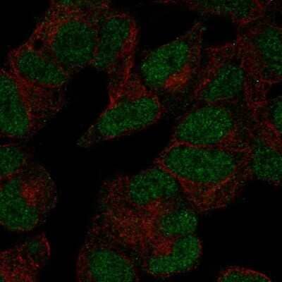 Immunocytochemistry/ Immunofluorescence: POLR3D Antibody [NBP2-55887]