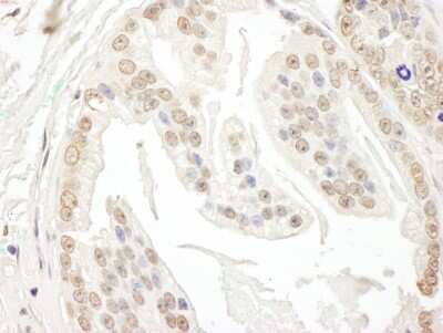 Immunohistochemistry: POLR3D Antibody [NBP1-28737]