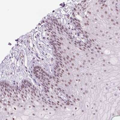 Immunohistochemistry-Paraffin: POLR3D Antibody [NBP2-49530]
