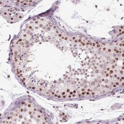 Immunohistochemistry: POLR3D Antibody [NBP2-49556]