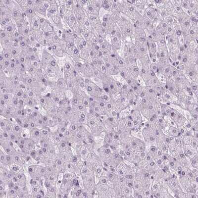 Immunohistochemistry-Paraffin: POLR3D Antibody [NBP2-49556]