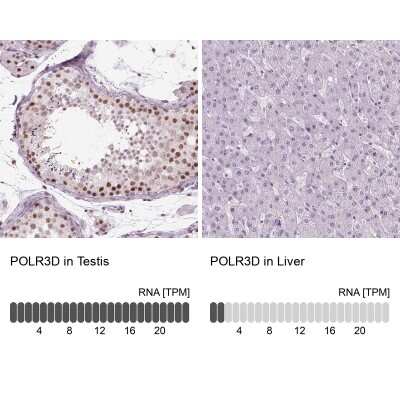 Immunohistochemistry-Paraffin: POLR3D Antibody [NBP2-49556]