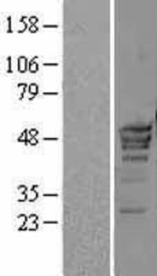 Western Blot: POLR3D Overexpression Lysate [NBL1-14592]