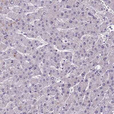 Immunohistochemistry-Paraffin: POLR3E Antibody [NBP1-84621]