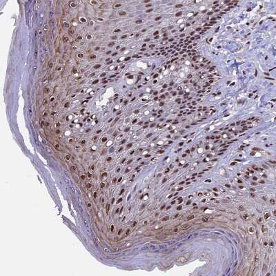 Immunohistochemistry-Paraffin: POLR3E Antibody [NBP1-84621]
